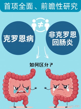 克罗恩病和溃疡性结肠炎的区别(克罗恩病和溃疡性结肠炎治疗方法一样吗)