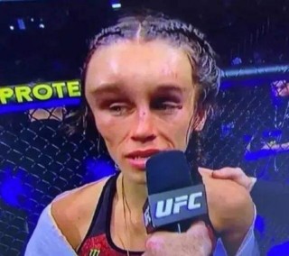 ufc被打出肠子(ufc选手被打出大便)