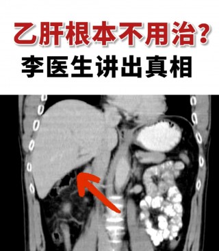 乙肝能治好吗(乙肝能治好吗女性)